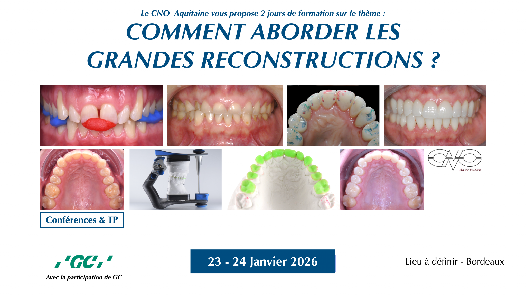 Grandes reconstructions 23-24:01:2026 